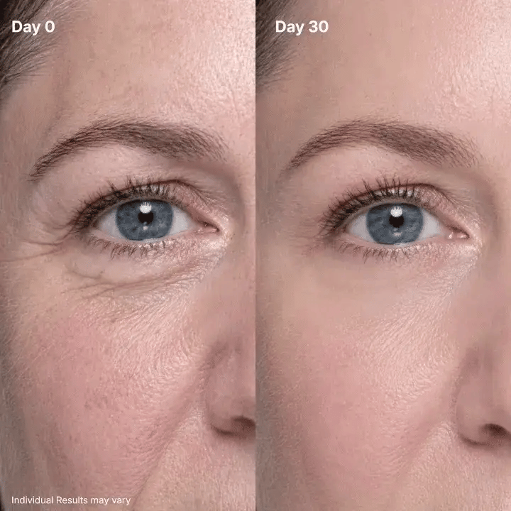 🔥Final 2 Hour 50% OFF🔥 P7 Eye Renewal Crème