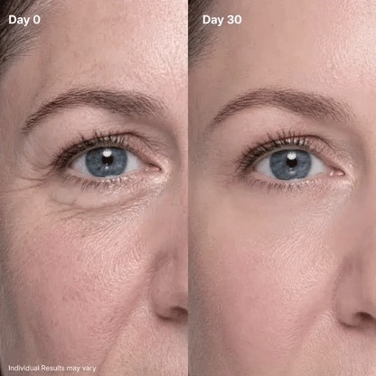 🔥Final 2 Hour 50% OFF🔥 P7 Eye Renewal Crème